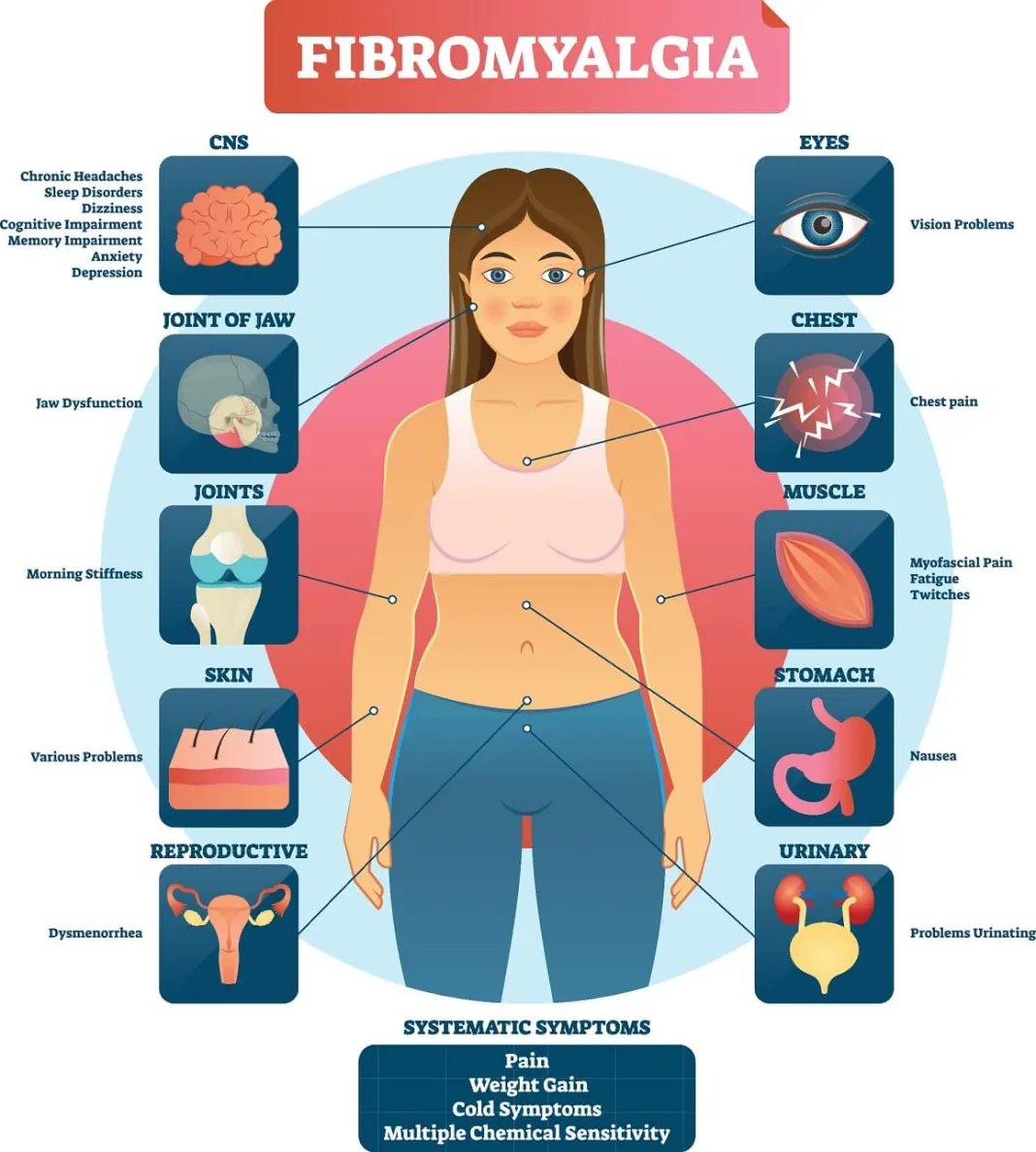 Fibromialgija