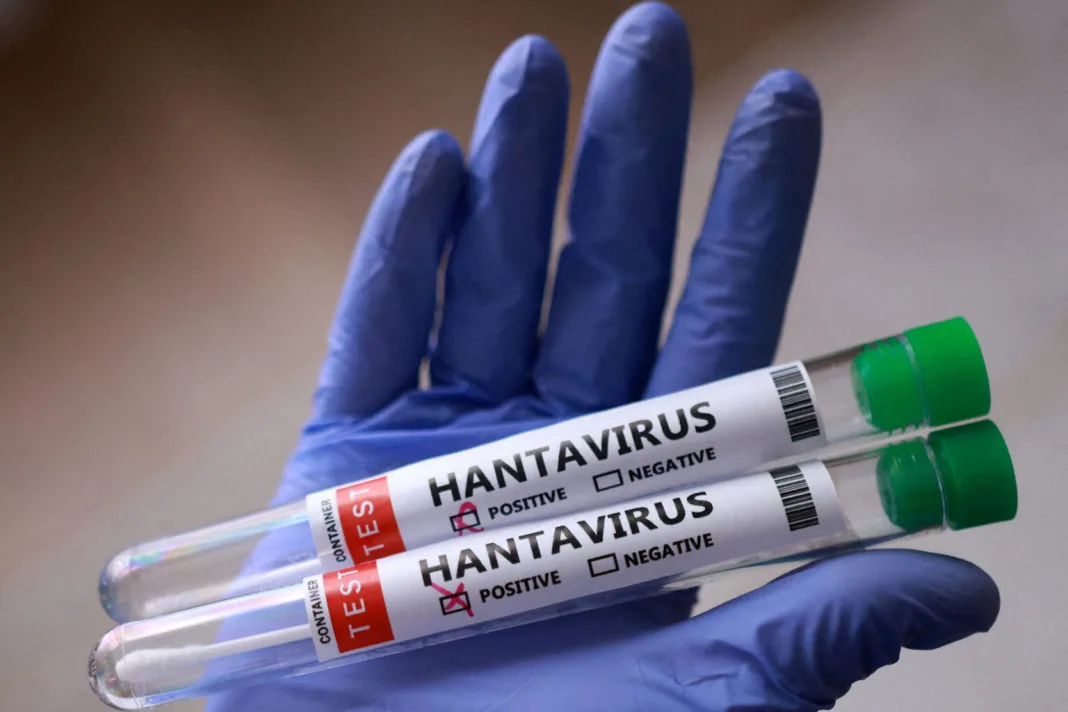 Šest slučajeva laboratorijski je potvrđeno kao infekcija hantavirusom, a svi su identificirani kao posljedica virusa Anda